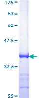 12.5% SDS-PAGE Stained with Coomassie Blue.